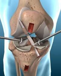 DR. MARCELO JITSUYO WADA  | CRM CRM 15354