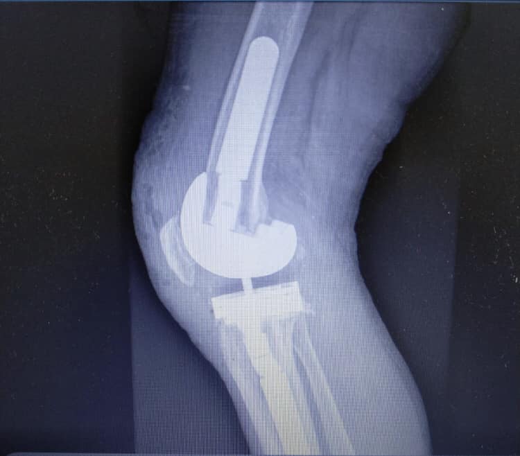 DR. LUÍS GUSTAVO DI PIERO MENDES